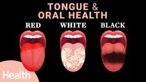 What Your Tongue Tells You About Your Health | Tongue Color, Taste Buds, COVID Tongue, & Oral Health