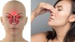 नाक में सूखापन क्यों होता है | Nose Dryness Symptoms और Causes | Boldsky
