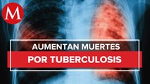 Día Mundial de la Tuberculosis: Qué es, síntomas, Tratamiento y cómo prevenirla