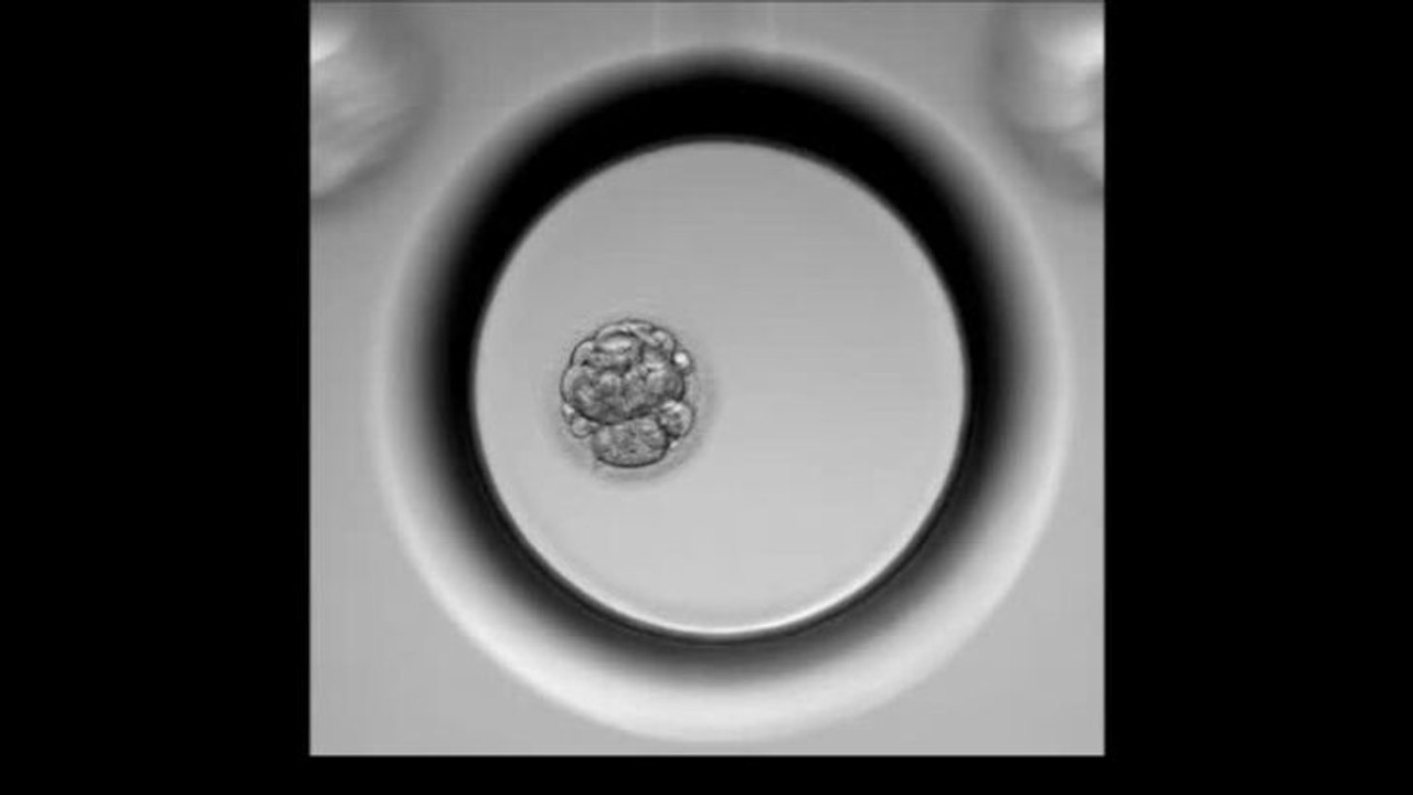 Embryo developing in Geri (2)