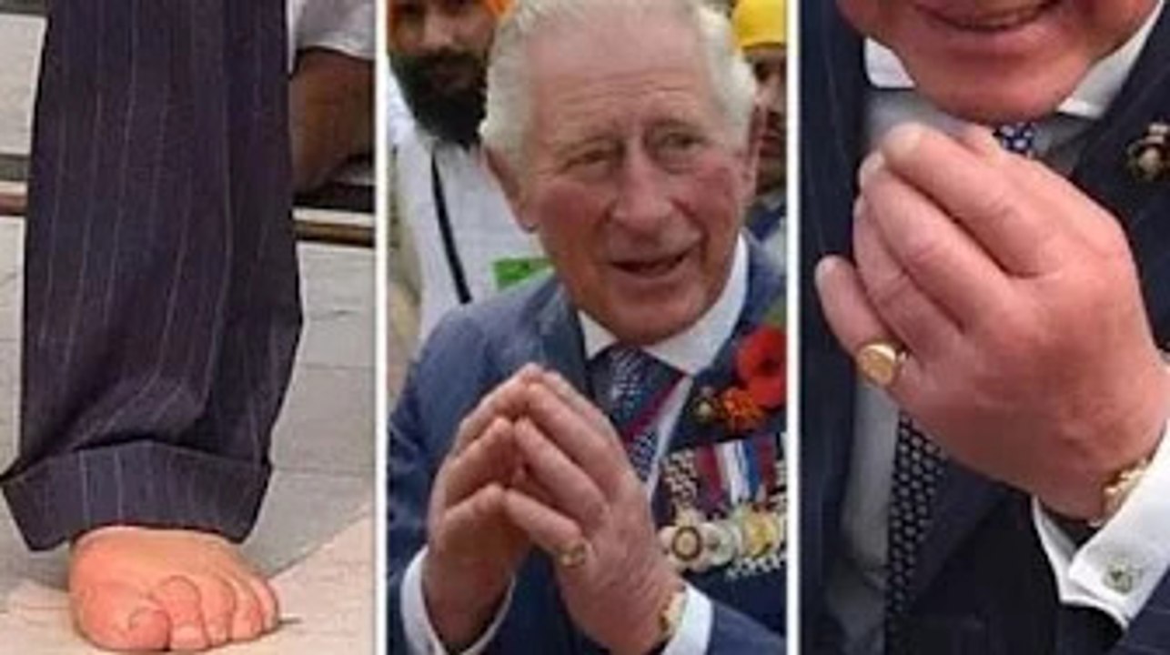 Santé du prince Charles: État des mains et des pieds enflés mis à nu – «Doigts de saucisse»
