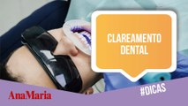 CLAREAMENTO DENTAL: SEIS MITOS QUE VOCÊ PRECISA SABER ANTES DE REALIZAR O PROCEDIMENTO (2022)