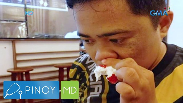 Lalaki, tatlong beses kada araw daw kung mag-nosebleed? | Pinoy MD
