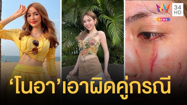 โนอา ภญมณ นักแสดงสาวถูกรุมตบกลางผับทองหล่อ ลุยแจ้งความคู่กรณี | ข่าวเที่ยงอมรินทร์ | 27 มี.ค.65