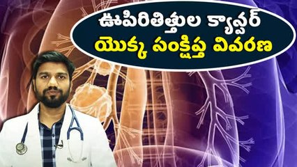 ఊపిరితిత్తుల క్యాన్సర్ గురించి కొన్ని విషయాలు