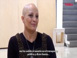 Alopecia femenina, más allá de Jada Pinkett: 