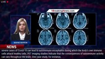 Imaging the Brain: What Brain Scans Reveal About the Consequences of Covid-19 - 1breakingnews.com