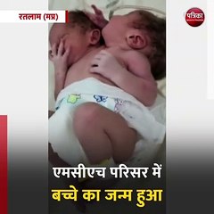 रतलाम (मप्र): दो मुँह के बच्चे ने लिया जन्म