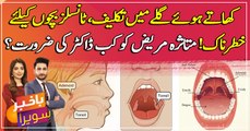 What are Tonsil Stones? Causes, symptoms and treatments