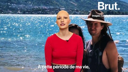 Le combat de Camila, mannequin atteinte d'alopécie