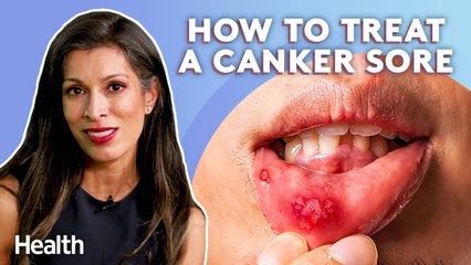 Periodontist Talks How To Avoid Mouth Disease, Canker Sores, and Dry Socket