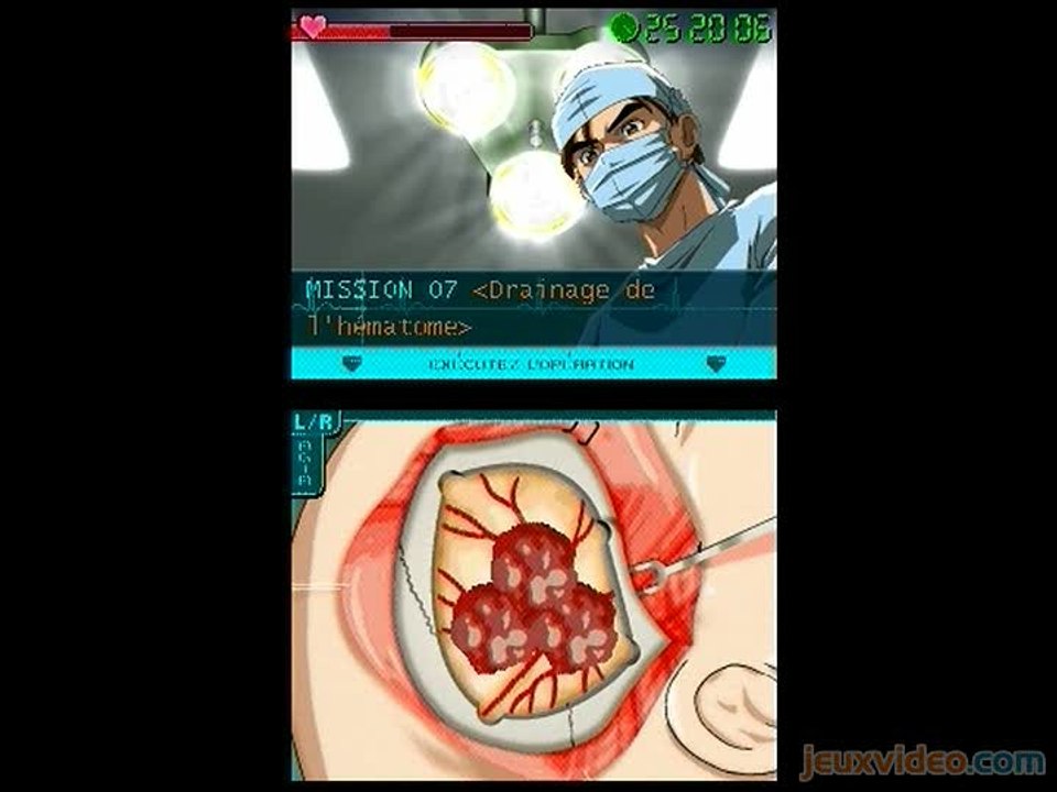 Lifesigns : A Coeur Ouvert : Trépanation crânienne