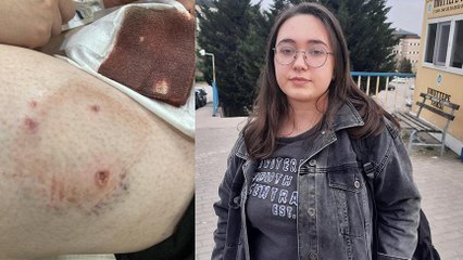 Kampüste köpeklerin saldırısına uğradı