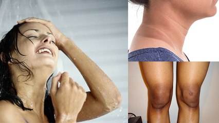 नहाने से 2 मिनट पहले Homemade Paste लगाने से Knee, Underarms के Darkness गायब | Boldsky