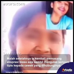 Apes! Gigi Palsu Cewek Tak Sengaja Copot Saat Asyik Video Call, Sikap Cowoknya Langsung Tuai Pujian