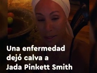 ENFERMEDAD Jada Pinkett Smith La esposa de Will Smith