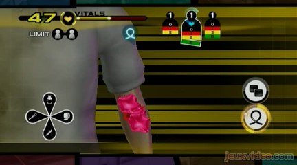 Trauma Team : Première intervention