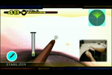 Trauma Team : Endoscopie