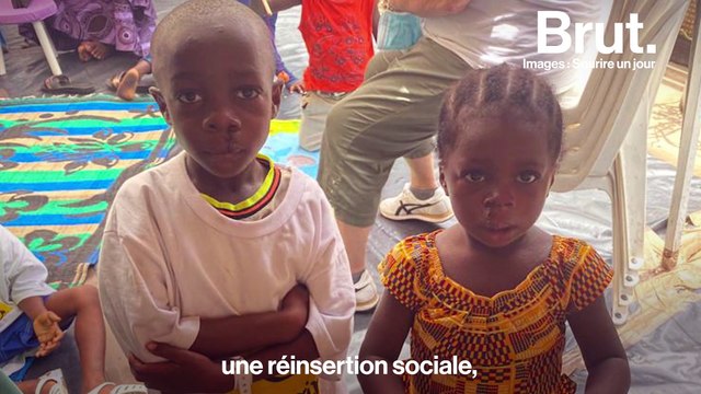 L'association Sourire un jour redonne un visage aux enfants défigurés