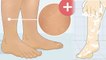 पैरों का रूखापन कैसे दूर करें | Pairo Ka Rukhapan Dur Karne Ka Tarika | Boldsky