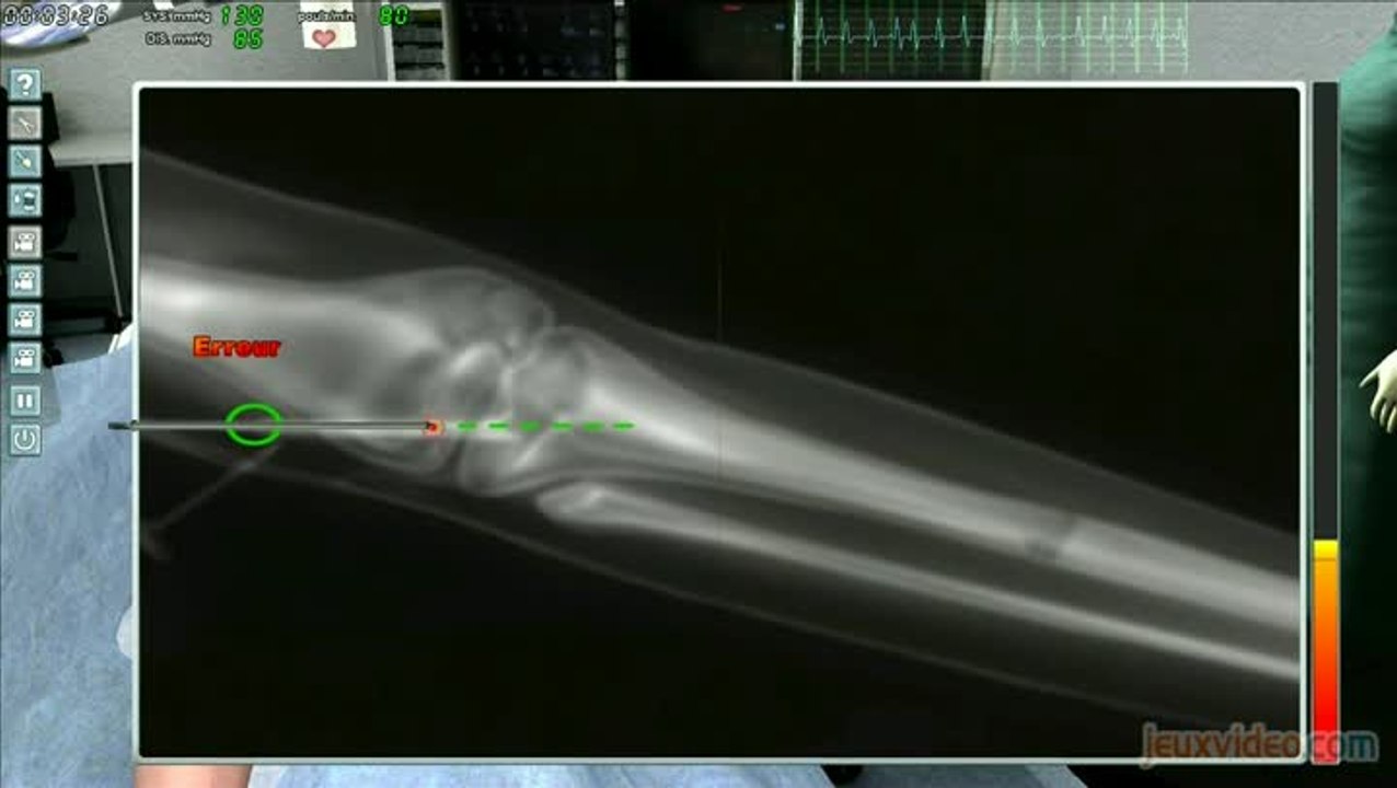 Chirurgie Simulator : Deux opérations sinon rien