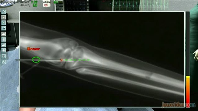 Chirurgie Simulator : Deux opérations sinon rien