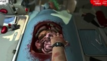 The Surgeon Simulator 2013 : De la chirurgie qui fait mal