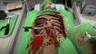 Surgeon Simulator : E3 2014 : Cours d'anatomie sur PS4