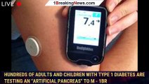 Hundreds of adults and children with type 1 diabetes are testing an 