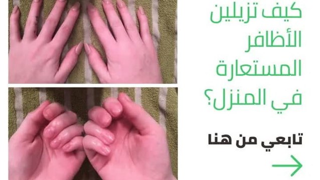 كيفية إزلة الأظافر المستعارة في المنزل