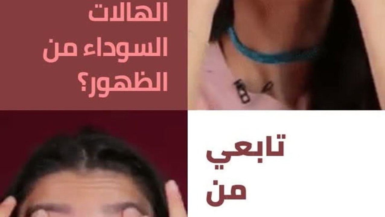 منع ظهور الهالات السوداء