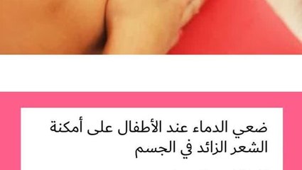 كيفية استخدام الدماء للشعر الزائد