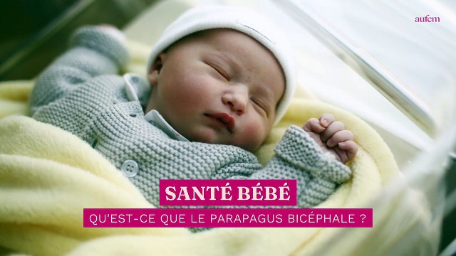 Qu’est-ce que le parapagus bicéphale, qui fait qu'un bébé est né avec 2 têtes, 3 bras et 2 cœurs ?