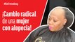 ¡Cambio radical La impresionante transformación de una mujer con alopecia