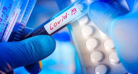 ‘Kovid-19’a karşı zerdeçal türevleriyle ilaç yapılabilir’