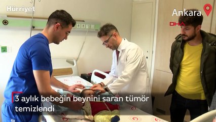 3 aylık bebeğin beynini saran tümör temizlendi