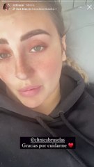 Rocío Flores, dolorida, reaparece y da todos los detalles de su operación estética y de su recuperación. IG