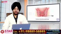 Fissure Operation, Fissure treatment, Fissure Meaning, Anal fissure, Fissure Lecture in Hindi