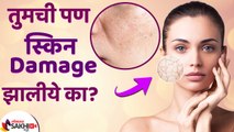 Damage Skin साठी करा हा घरगुती उपाय | How to Repair Damaged Skin | Damaged Skin Barrier