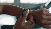 "Rötungen, Schwellungen, Jucken": Apple Watch kann zu Hautausschlag führen