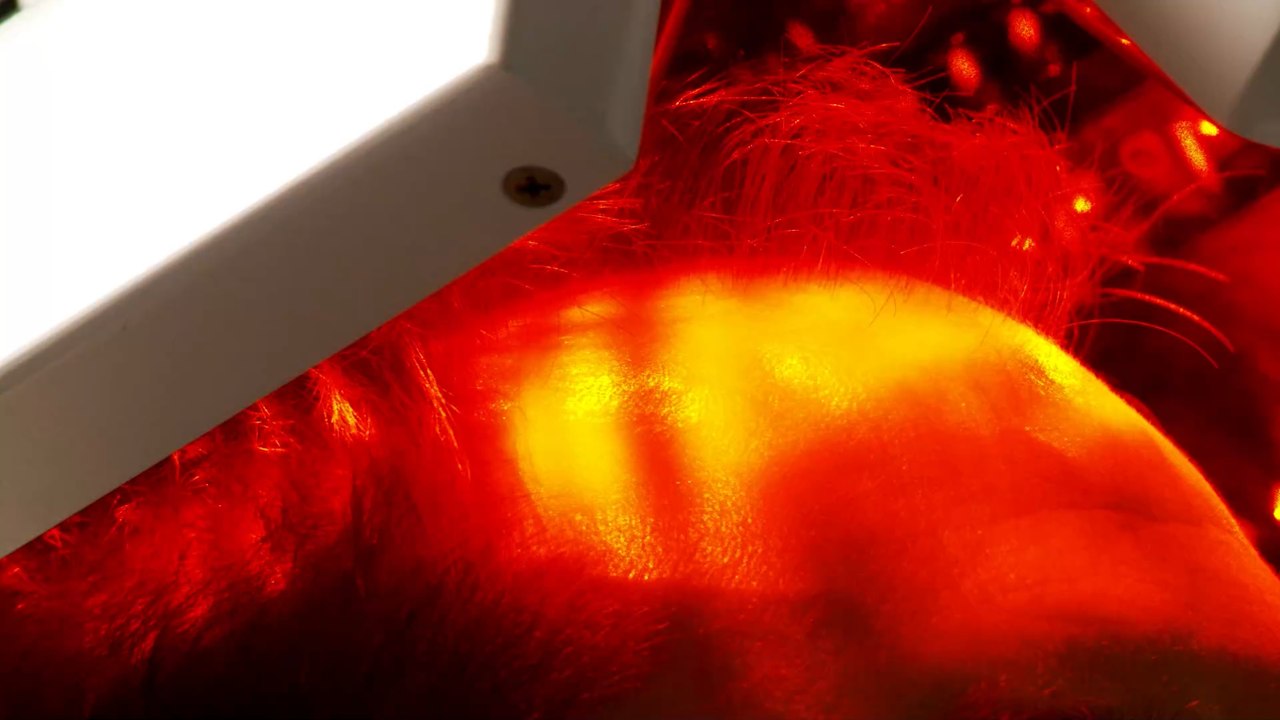 'Arsch eines Babys': Robbie Williams will wegen missglückter Haartransplantation jetzt Perücke tragen