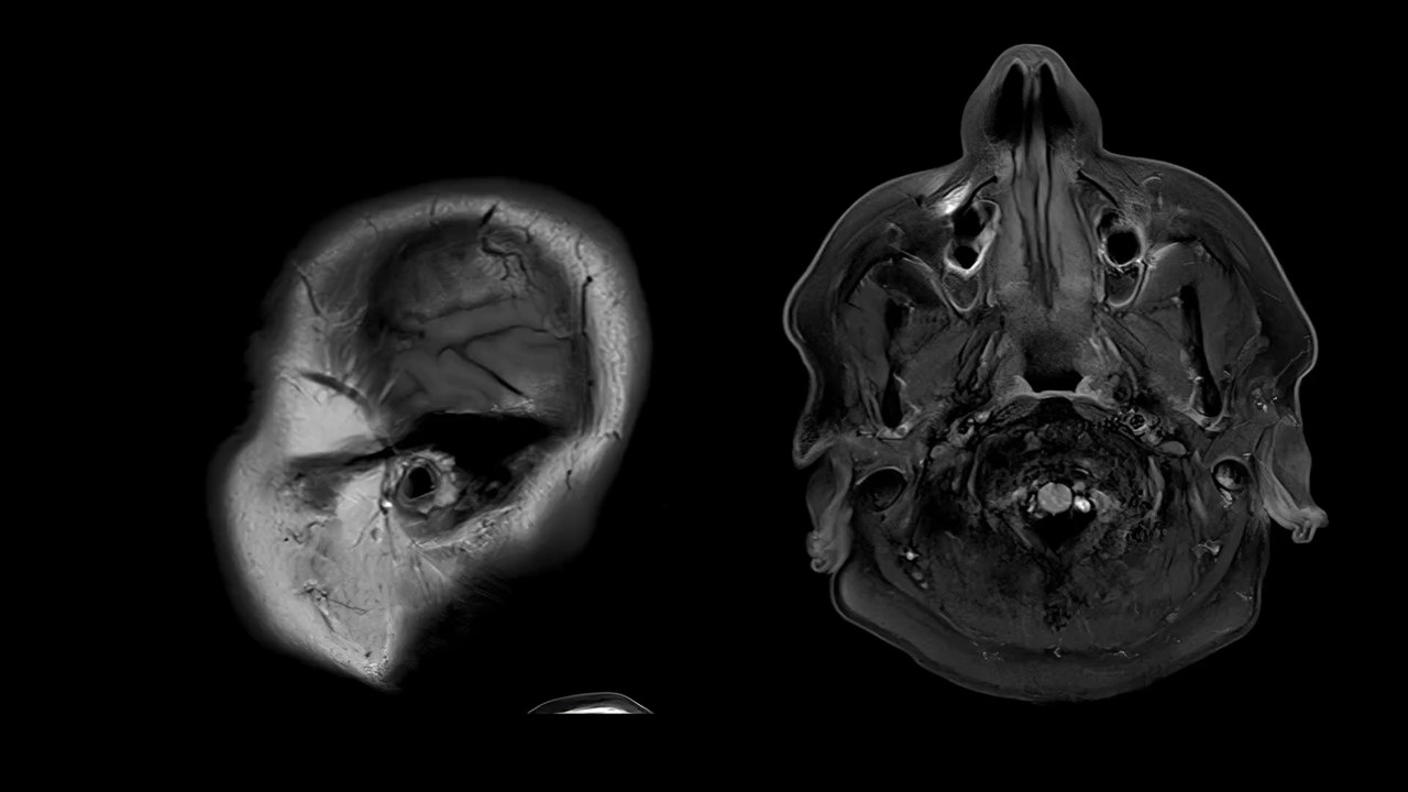 Arzt sagt: 'Wer sich noch nicht mit Corona angesteckt hat, hat wahrscheinlich Beziehungsprobleme'