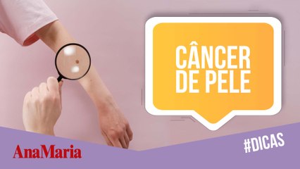 CÂNCER DE PELE: SAIBA AS DICAS PARA PREVENIR A DOENÇA (2022)