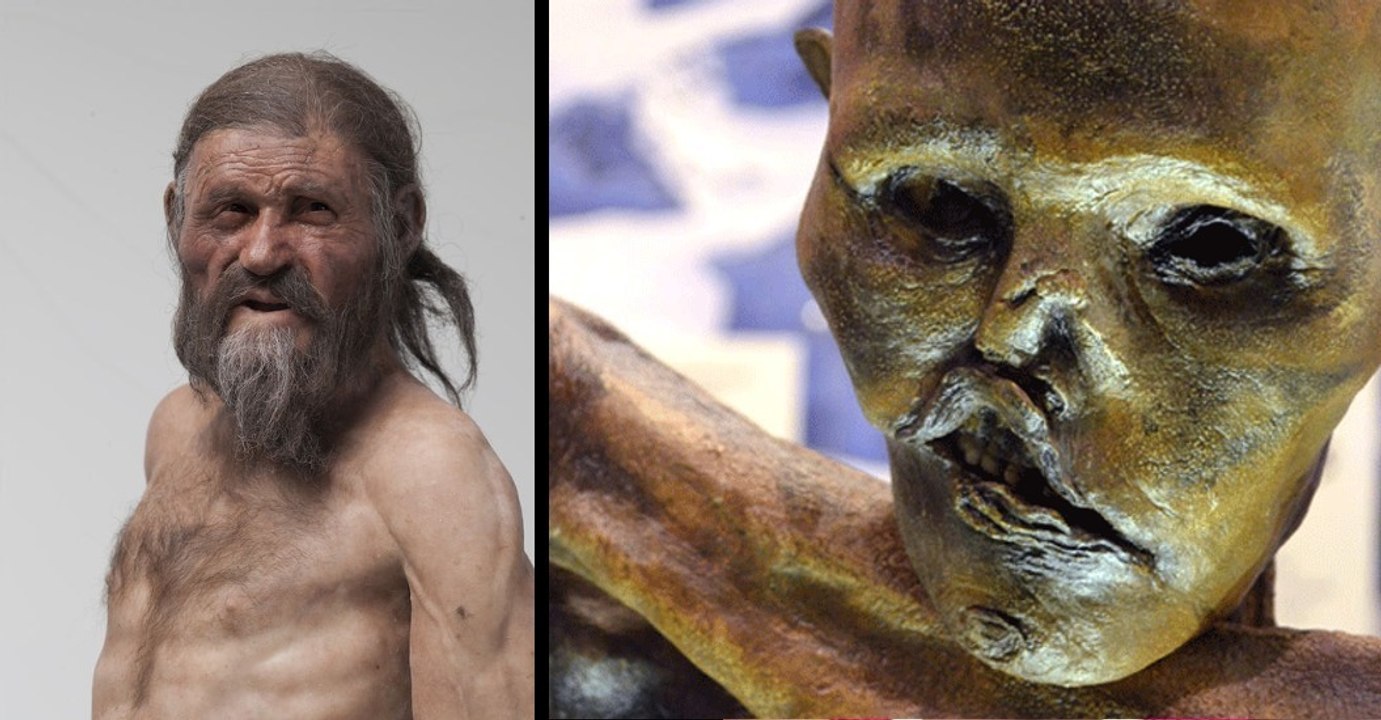 Ötzi: Die Todesursache der ältesten Mumie der Welt