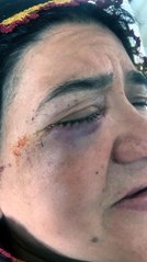 OTOMOBİLDEN HAVAYA ATEŞ AÇILDI, PENCEREDEKİ KADIN VURULDU