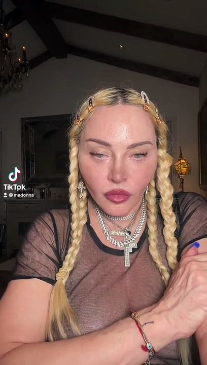 Madonna dévoile son visage tout refait et ça fait flipper