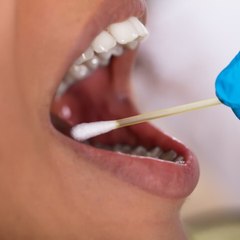 CAM - Test salivaire : comment ça marche ?