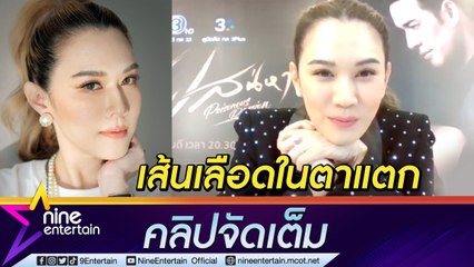“เมย์ ปทิดา” ตกใจ! โหมงานหนัก จนเส้นเลือดในตาแตก (คลิปจัดเต็ม)