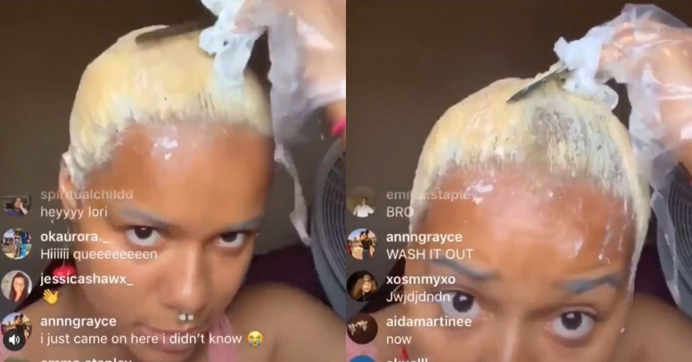 Chica quedó completamente calva mientras lo decoloraba en una transmisión en vivo