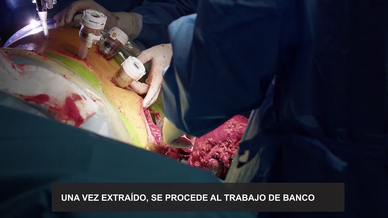 El Reina Sofía realiza por primera vez un trasplante renal cruzado junto a otros dos centros